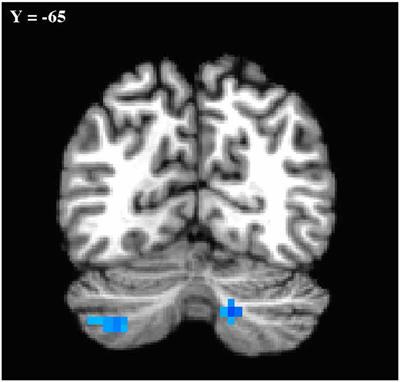 Sex Differences in Resting-State Functional Connectivity of the Cerebellum in Autism Spectrum Disorder